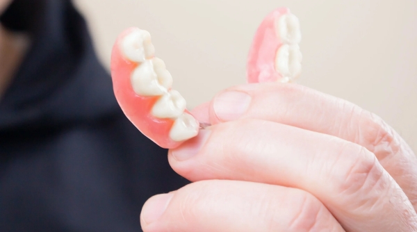 gedeeltelijk gebitsprothese | Dental Design