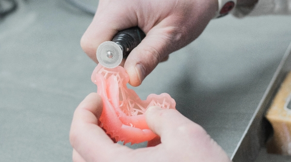 kunstgebit laten repareren | Dental Design Utrecht